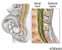 Epidural - series