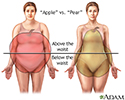 Different types of weight gain