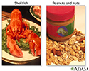 Food allergies