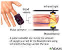 Pulse oximeter