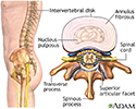 Intervertebral disk