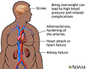 Obesity and health