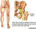 Sciatic nerve