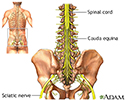 Cauda equina