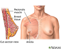 Breast augmentation - series - Normal anatomy