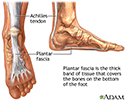 Plantar fascia