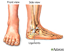 Ankle sprain - Series