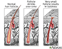 Hair follicle