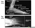 Normal foot X-ray