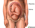 Placenta