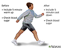 Diabetes and exercise