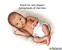 Diapers and diarrhea