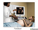 Ultrasound in pregnancy