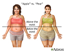 Different types of weight gain