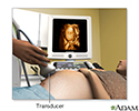 3D ultrasound