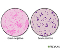 Gram stain