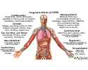 Long-term effects of COVID