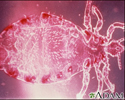 Head louse, male
