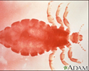 Head louse - female