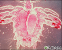 Crab louse, female