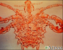 Pubic louse-male