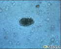 Hookworm egg