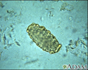 Ascaris lumbricoides egg