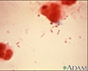 Haemophilus influenzae organism