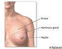 Breast lump removal - series - Normal anatomy