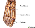 Bunion removal - Series