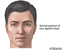 Ear surgery - series