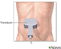 Abdominal ultrasound