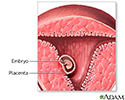 Early pregnancy