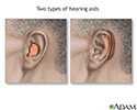 Hearing aids