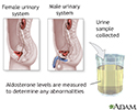 Aldosterone level test
