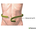 Abdominal girth measurement