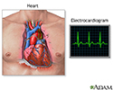 Electrocardiogram (ECG)