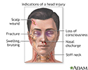 Indications of head injury