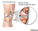 Medial collateral ligament