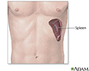 Spleen