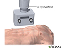 X-ray