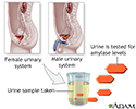 Amylase urine test