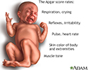 Newborn test