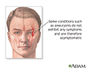 Asymptomatic conditions