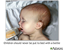 Baby bottle tooth decay