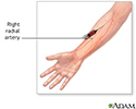 Blood gases test