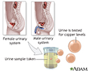 Copper urine test