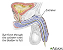 Cystography