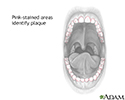 Dental plaque stain