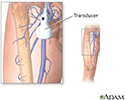 Doppler ultrasonography of an extremity